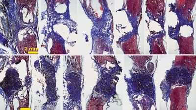 Avance científico 'made in Madrid': espuma de grafeno para poder curar lesiones medulares