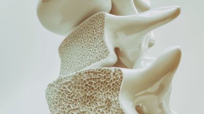 La caída de la testosterona en los hombres: causas, síntomas y tratamientos