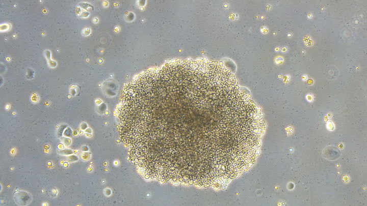Investigadores del CSIC describen un nuevo mecanismo molecular de resistencia a la quimioterapia / CSIC