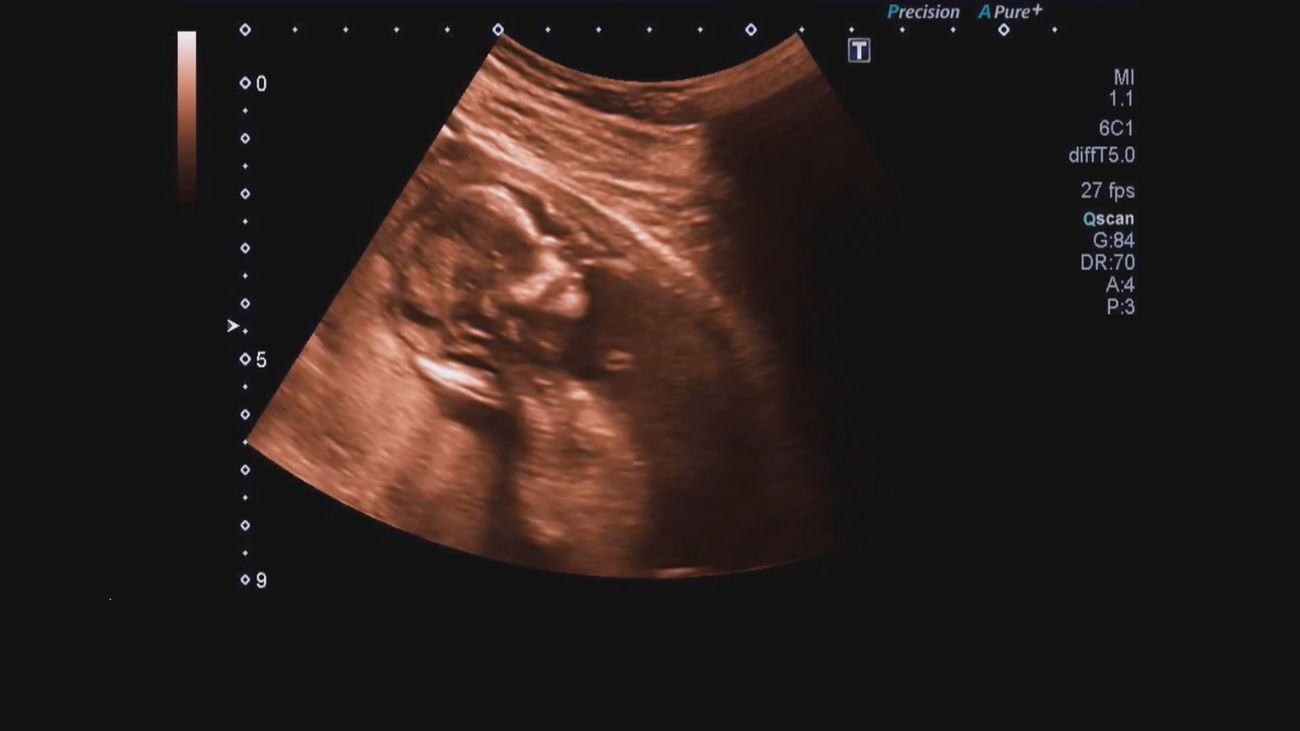 Alimentación en el embarazo: lo que debes saber para cuidar tu salud y la del bebé