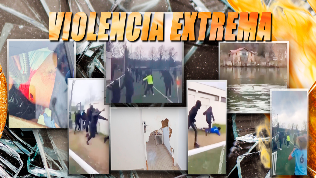 Brutal emboscada en el fútbol francés