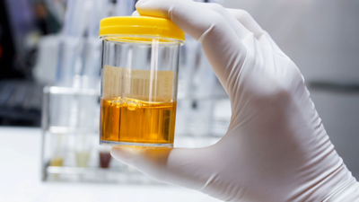 ¿Qué dice el color de la orina sobre tu estado de salud?