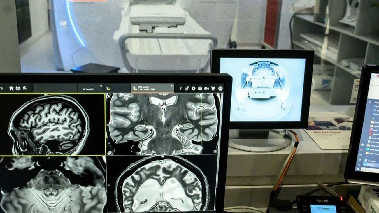 Fundación CIEN: investigación pionera en enfermedades neurodegenerativas