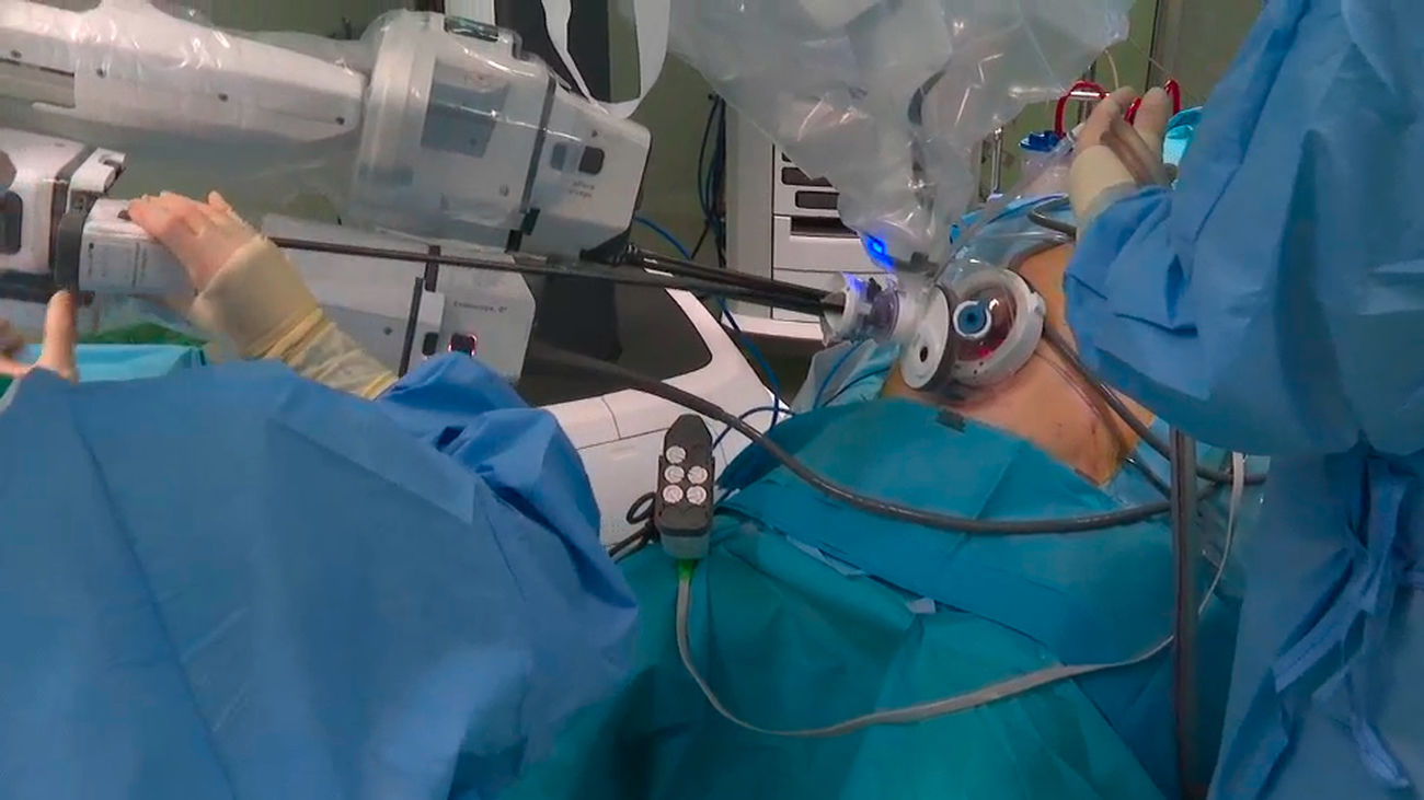 Primera cirugía con un robot de un solo brazo realizada en un hospital de Madrid