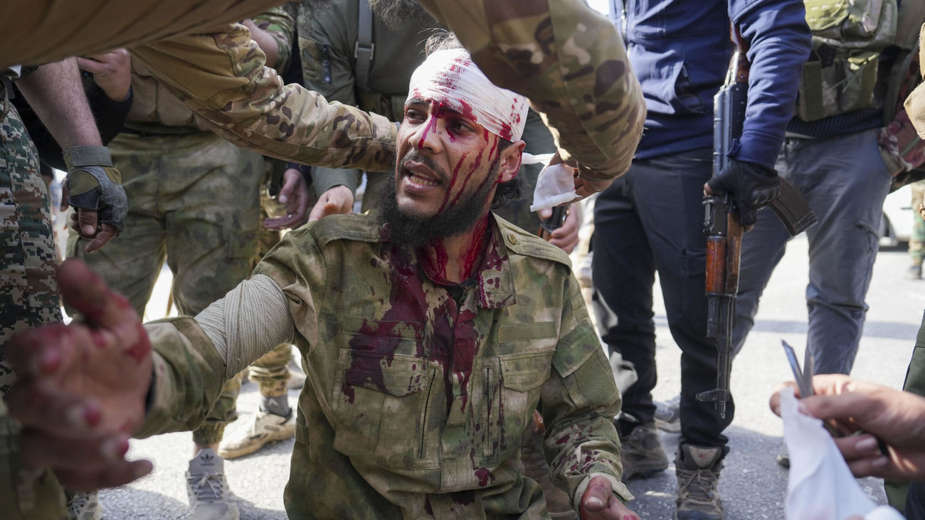 Soldado sirio herido