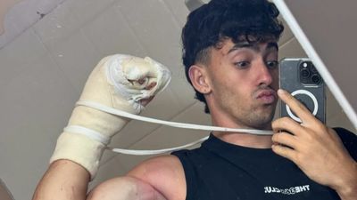 El influencer Gero Arias pierde dos dedos tras caer de un acantilado