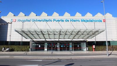 El Puerta de Hierro aplica con éxito una técnica para cerrar una fístula esófago-bronquial en un paciente de 84 años