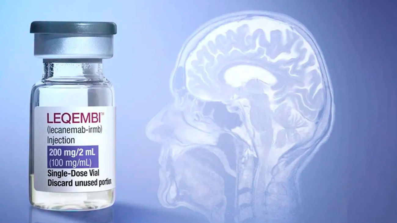 La Comisión Europea autoriza 'Leqembi', el primer tratamiento que ralentiza el deterioro cognitivo en alzhéimer