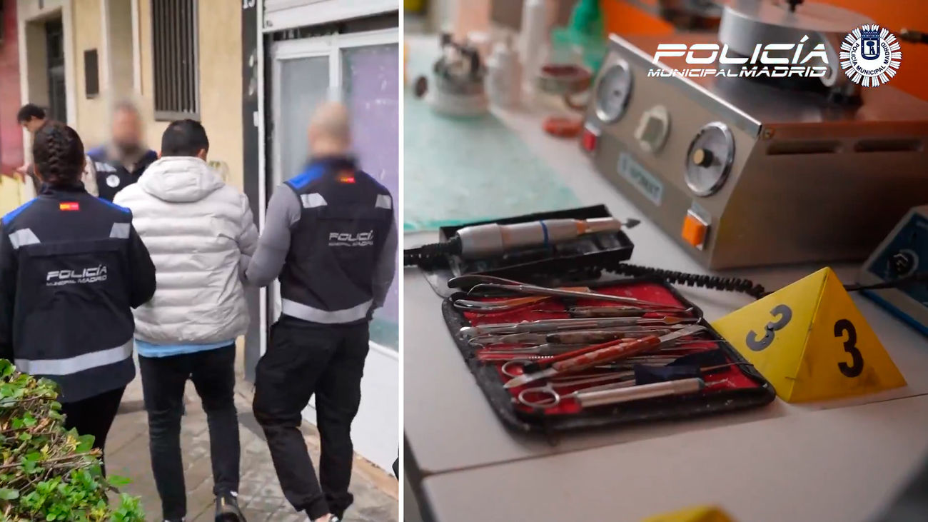 Detenido un dentista 'pirata' por realizar prótesis ilegales en una clínica clandestina de Villaverde