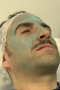 Así es el innovador tratamiento dermatológico contra el melasma que deja la piel de color azul