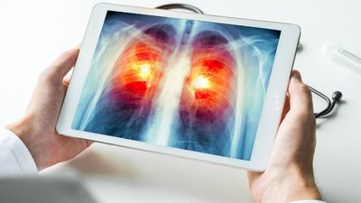 El cáncer se consolida como la primera causa de muerte en España en 2024