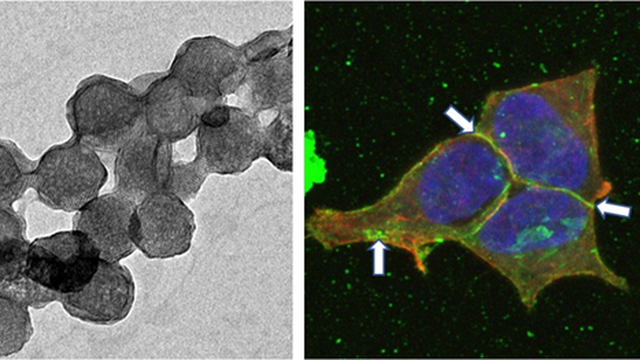 Imágenes microscópicas de las protocélulas y  de las células de neuroblastoma marcadas con fluoresceína (flechas blancas)