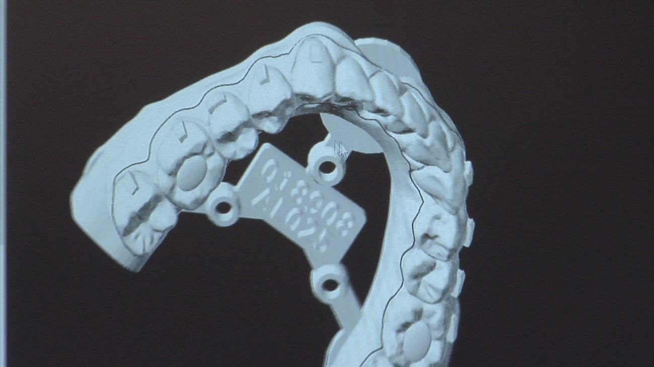 Ortodoncia invisible 100% madrileña impulsada por la Inteligencia Artificial