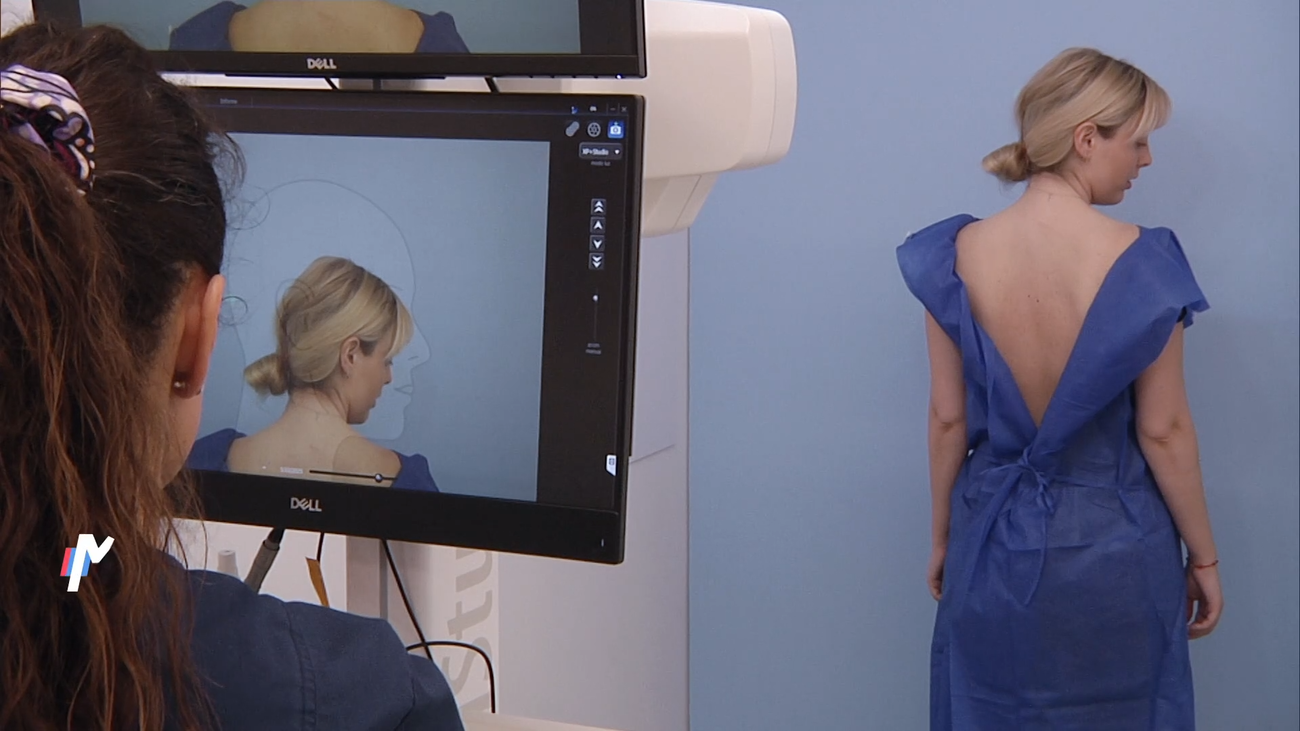 Lunares: ¿Cuándo preocuparse y cómo detectarlos a tiempo?