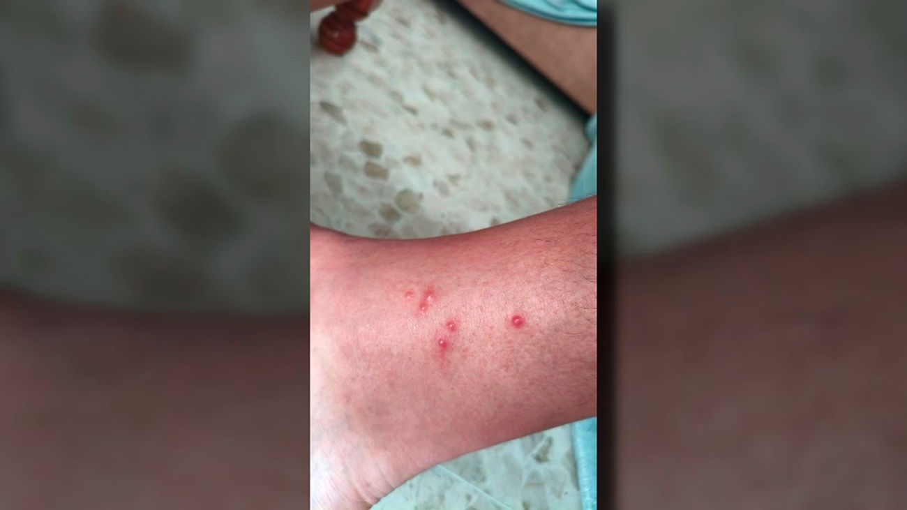 La Comunidad dice no haber recibido comunicación por parte de Aena de una plaga de chinches en Barajas