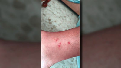 La Comunidad dice no haber recibido comunicación por parte de Aena de una plaga de chinches en Barajas