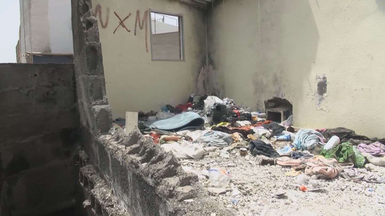 Prisión provisional para el joven detenido por las quemaduras de una menor en Las Palmas de Gran Canaria