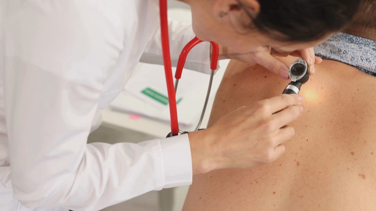 Fotoprotección y diagnóstico precoz, claves contra el cáncer de piel