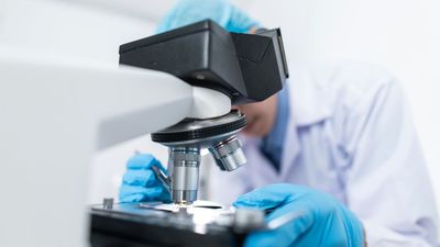 'KCL-HO-1i', el nuevo fármaco contra el cáncer que promete una quimioterapia más eficaz incluso en tumores resistentes