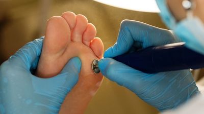 Majadahonda subvenciona hasta 72 euros el podólogo de sus mayores