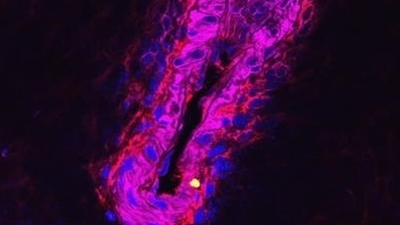 Aumentan los casos de neumonía entre la población por el consumo de tabaco, alcohol y otras drogas