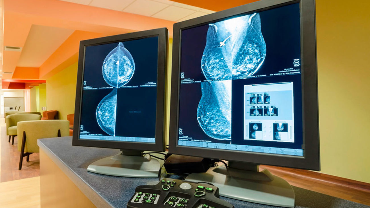 El protocolo de 'la vergüenza' sobre las mamografías en Andalucía data de 2011