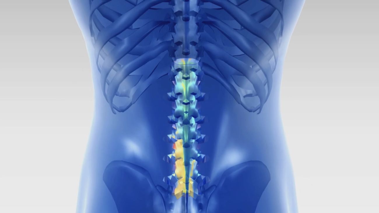 La neurodinamia: una técnica para liberar los nervios y mejorar la movilidad