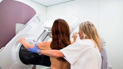 Los cribados de cáncer de mama llegan al Parlamento regional de Madrid