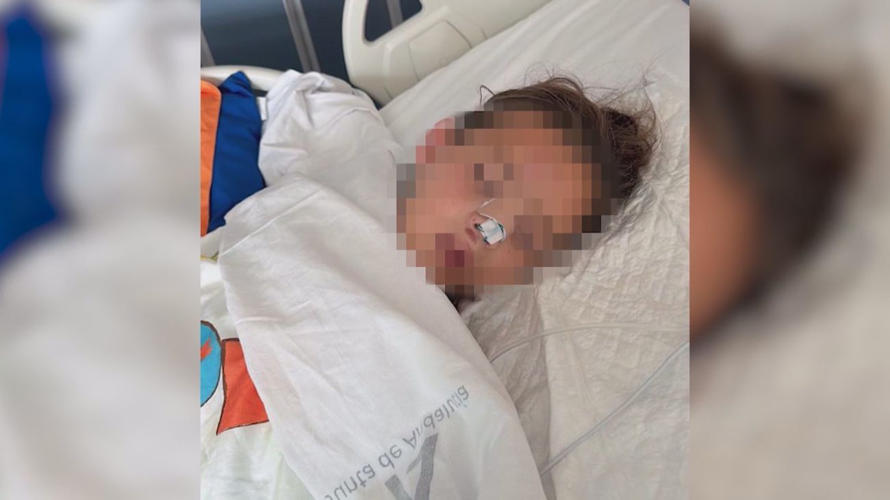 Una niña de 7 años operada con fractura de nariz tras sufrir acoso en un colegio de Marbella