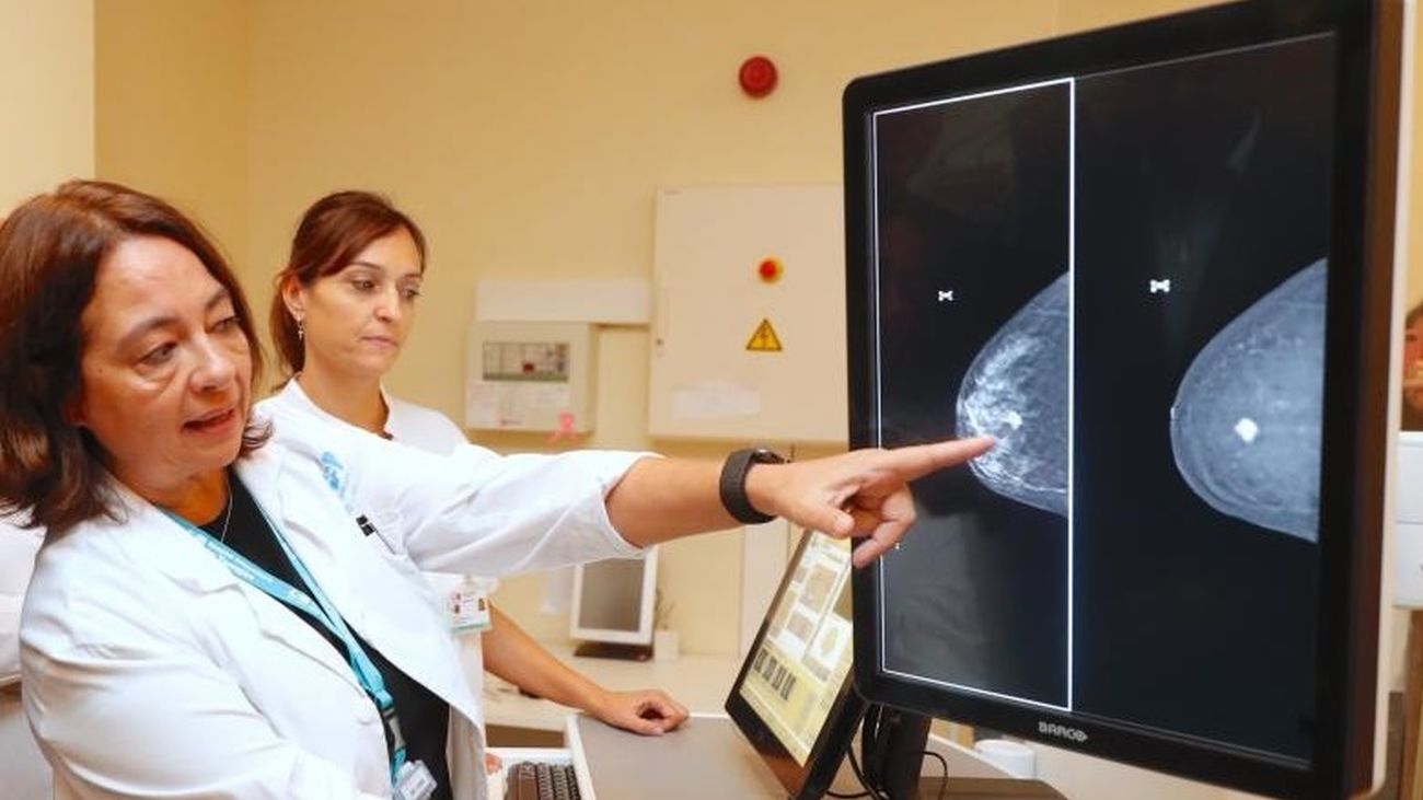 Madrid incorporará mamógrafos digitales 3D para la detección del cáncer de mama en todos sus hospitales