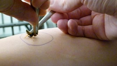 El Hospital de Alcorcón, referente en manejo personalizado de alergias a abejas y avispas