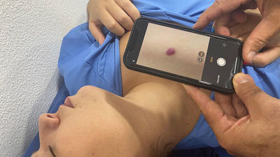 LA IA no sustituye al médico, los peligros de autodiagnóstico digital