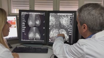 La Fiscalía andaluza no ve indicios de delito contra aforados en los cribados del cáncer