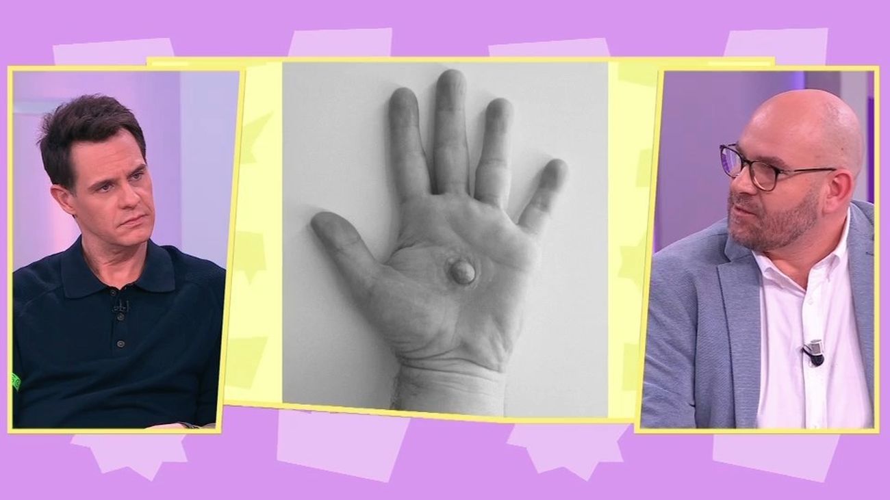 Alejandro Balo impulsa prótesis que devuelven identidad tras el cáncer de mama