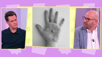 Alejandro Balo impulsa prótesis que devuelven identidad tras el cáncer de mama