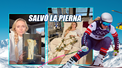 Lindsey Vonn confiesa que casi tienen que amputarle la pierna tras su caída en los Juegos