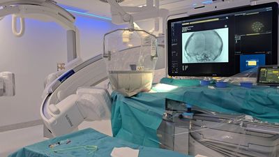 La Unidad de Radiología Intervencionista del 12 de Octubre supera los 1.200 procedimientos en un año