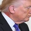 Vuelve a preocupar la salud de Trump por una mancha en su cuello