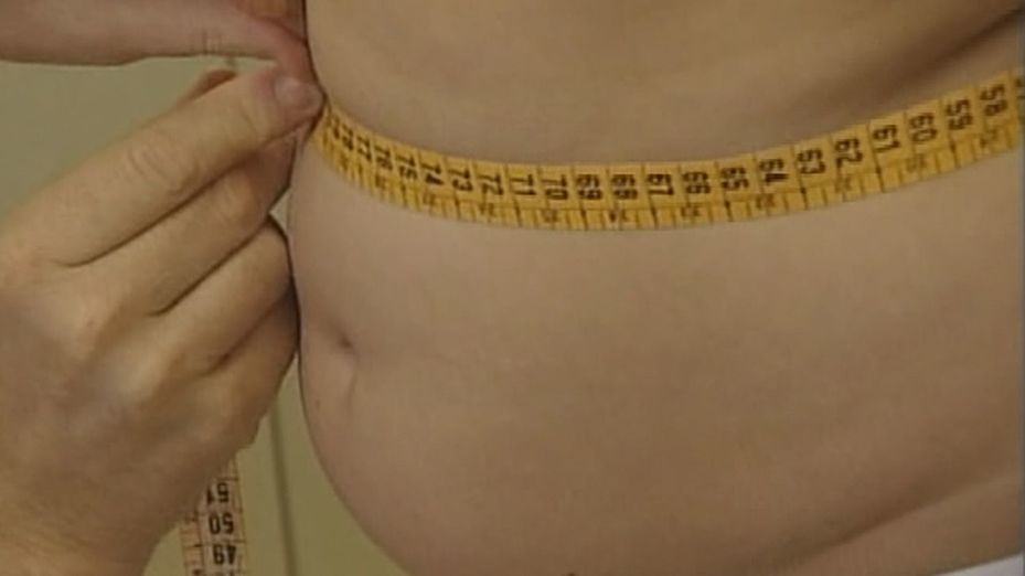 La obesidad ya afecta a más de 1.000 millones de personas en el mundo