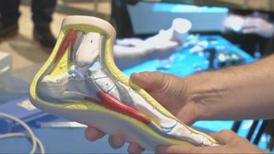 Cirugía en directo e impresión 3D: la podología más puntera se cita en Madrid en su 41 congreso