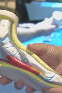 Cirugía en directo e impresión 3D: la podología más puntera se cita en Madrid en su 41 congreso