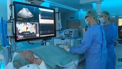 El Hospital Clínico San Carlos, el primero en el mundo en operar el corazón con navegadores 3D