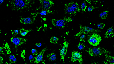 Autorizan el ensayo clínico del fármaco contra la ELA desarrollado por el CSIC