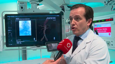 El Clínico San Carlos incorpora un quirófano cardiovascular pionero en España