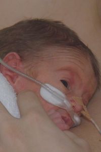 El Hospital 12 de Octubre se consolida como pionero en la técnica piel con piel para bebés prematuros