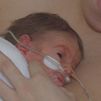 El Hospital 12 de Octubre se consolida como pionero en la técnica piel con piel para bebés prematuros