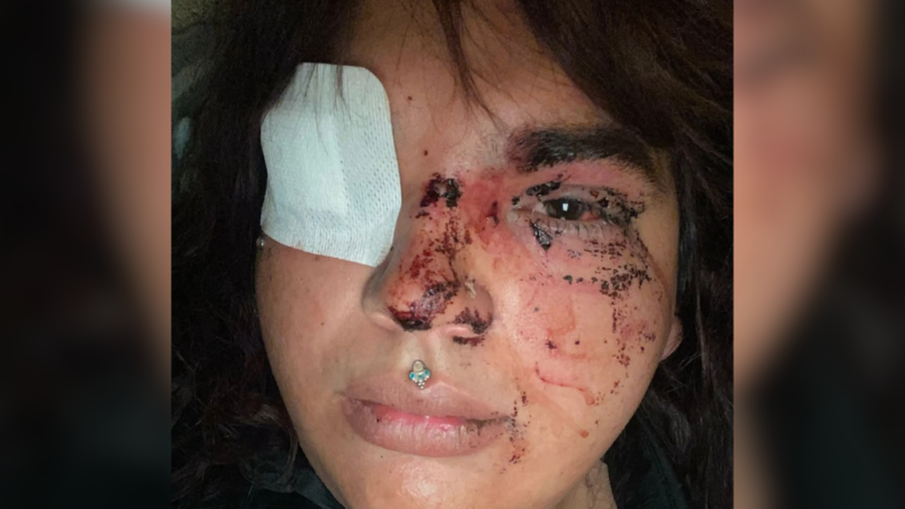 Bianca Lizbeth Fernández, Miss Trans Zamora 2024