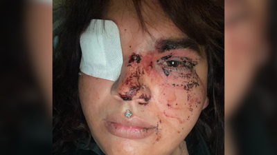 Detenidas 5 mujeres por la paliza a una mujer transexual en La Bañeza (León)