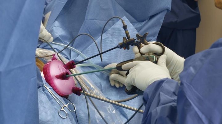 Intervención de ovario