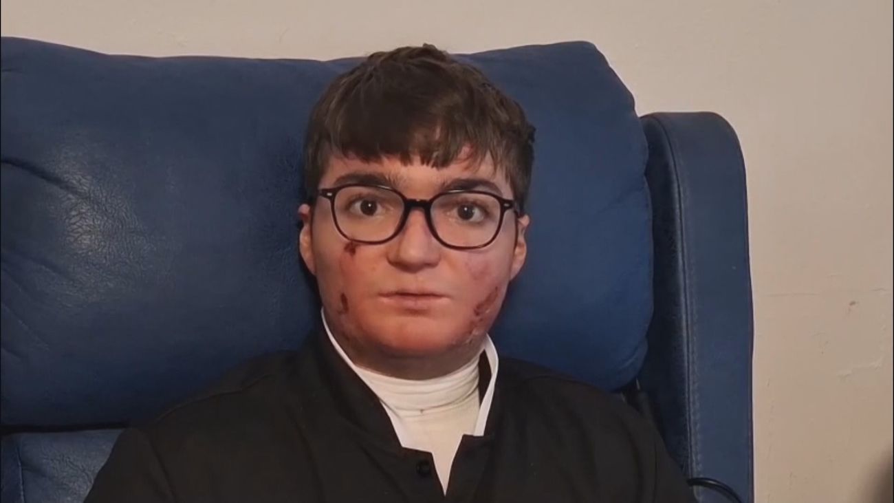 Pacientes de piel de mariposa, felices al recibir el nuevo 'oro' medicinal que les mejora